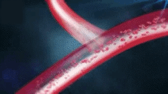 Application GIF