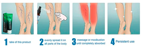 Varicose Veins Application