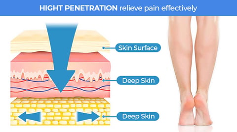 Vein relief